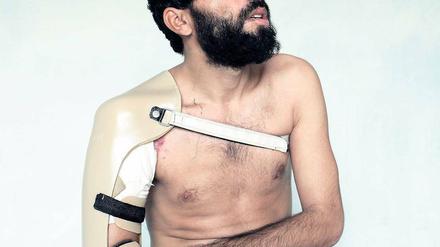 Gesicht und Geschichte. Ein Bild aus der Ausstellung „Kunduz, 4. September 2009“. Eine Explosion riss dem 27-jährigen Mann die rechte Hand ab. 