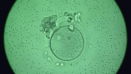 Die mikroskopische Aufnahme zeigt eine menschliche Eizelle, die von Spermien umgeben ist. 