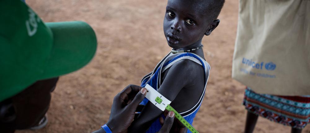 Ein Mann misst den Armumfang eines Jungen in einer Hilfeeinrichtung, die von der UNICEF unterstützt wird. Er untersucht, ob das Kind an Unterernährung leidet.