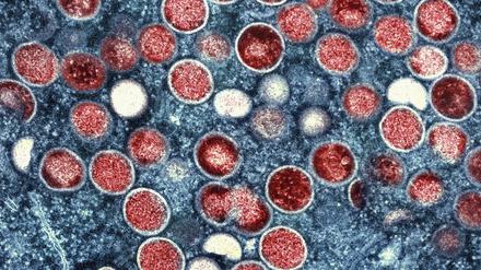 ARCHIV - 26.07.2022, USA, Fort Detrick: Eine eingefärbte Mikroskopaufnahme von Mpox-Partikeln (rot) in einer infizierten Zelle (blau), die im Labor kultiviert wurde. (zu dpa «35 Mpox-Fälle in Berlin seit Ende Juli») Foto: National Institute of Allergy and Infectious Diseases/AP/dpa - ACHTUNG: Nur zur redaktionellen Verwendung und nur mit vollständiger Nennung des vorstehenden Credits +++ dpa-Bildfunk +++
