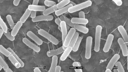Das Urzeit-Bakterium wurde der Gattung von Bacillus sphaericus zugeordnet.