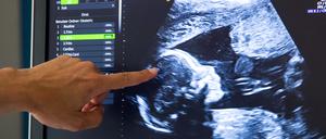Ein Ultraschallbild in einer Frauenklinik. 