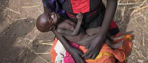 Viele Kinder sind unterernährt. Die UN erklärten bereits Februar für Teile des Südsudans eine Hungersnot.