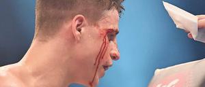 So sehen Sieger aus (II). Tyron Zeuge, gezeichnet von einem Kopfstoß seines Gegners Isaac Ekpo. 