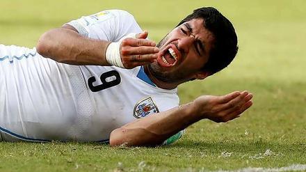 Schmerzhafter Biss. Luis Suarez muss die WM in Brasilien durch die Hintertür verlassen.