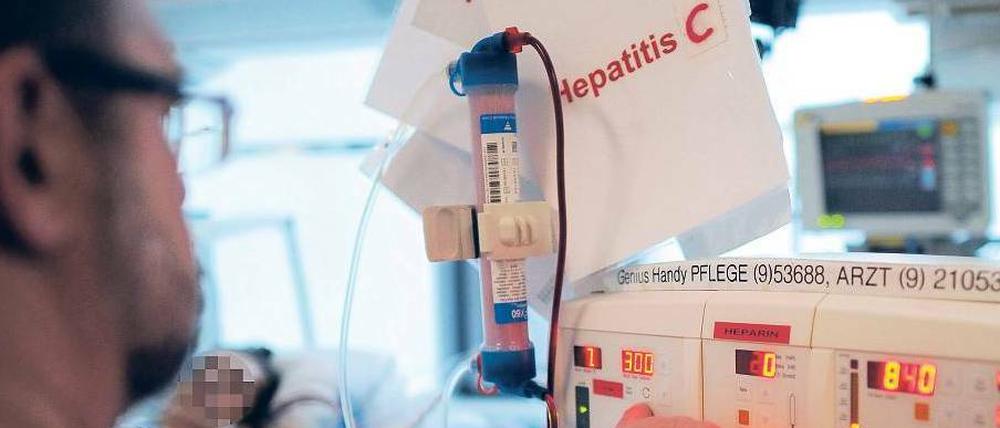 Hepatitis-C-Patient auf der Intensivstation