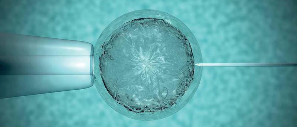 In-vitro-Befruchtung