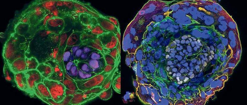 Zu sehen sind zwei unterschiedlich eingefärbte Abbildungen eines in der Petrischale gewachsenen Embryos.