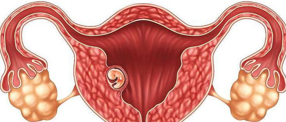 Nistplatz. In einer jungen Gebärmutter wachsen Embryonen besser an.