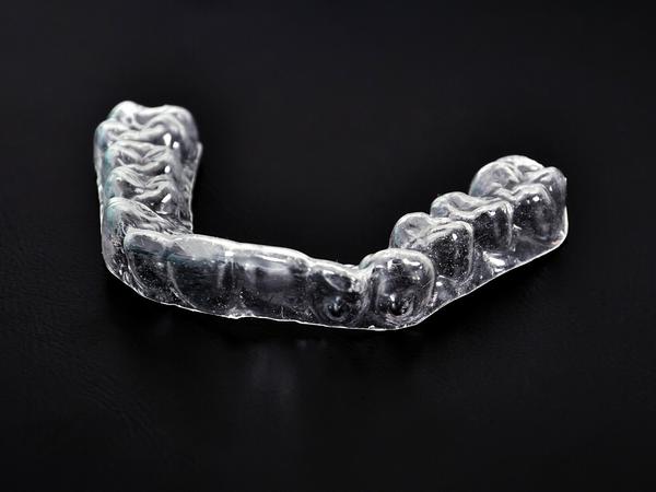 Eine Zahnschiene kann gegen die Abnutzung der Zähne durch Zähneknirschen helfen. 