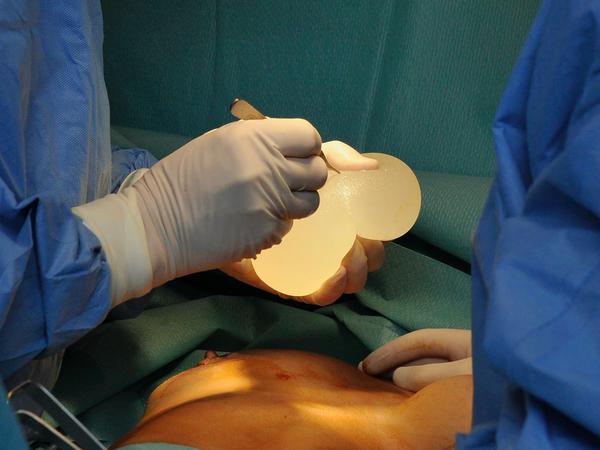 Chirurgen hantieren während einer Brust-OP mit Brustimplantaten. 