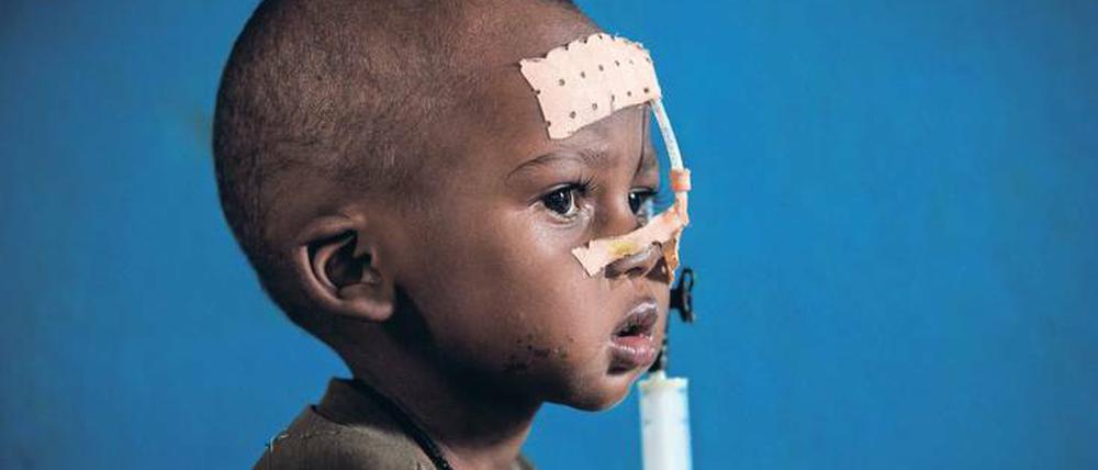 In den Krankenhäusern der Zentralafrikanischen Republik liegen besonders viele Kinder