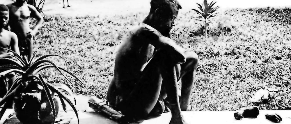 Ermordet und verstümmelt: Das Bild eines Plantagenarbeiters in Belgisch-Kongo, der vor der abgeschlagenen Hand und dem Fuß seiner Tochter sitzt, brachte die westliche Öffentlichkeit gegen den belgischen König Leopold II. auf.
