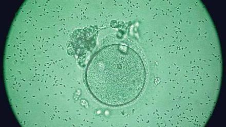 Künstliche Befruchtung mit großen Folgen. Die Mikroskopaufnahme zeigt eine Eizelle, die von Samenzellen umgeben ist. Foto: dpa