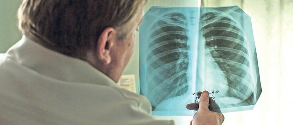 Ein Arzt betrachtet in einem ukrainischen Tuberkulose-Behandlungszentrum die Röntgenaufnahme einer Lunge.