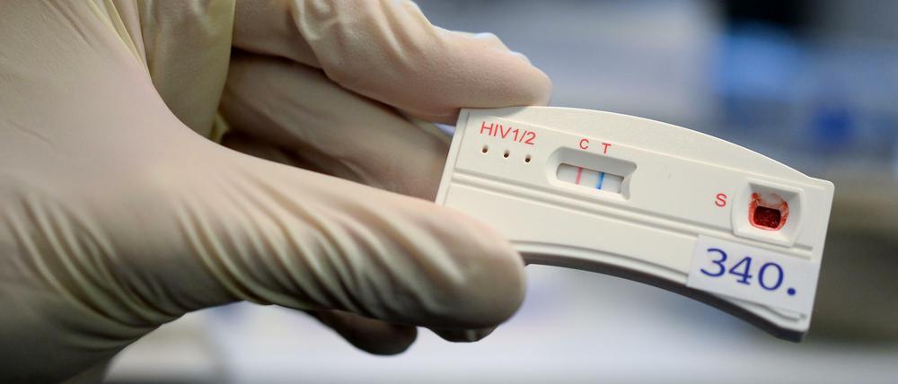 HIV-Tests gab es bisher nur in Arzt-Praxen.