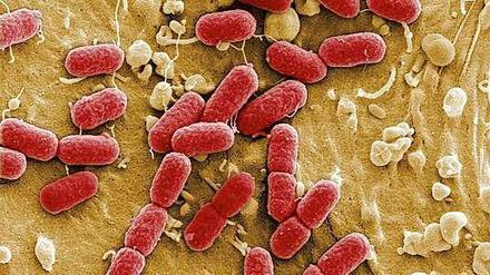 EHEC-Bakterien,eine gefährlichen Variante des harmlosen Darmbewohners Escherichia coli, unter dem Elektronenmikroskop.