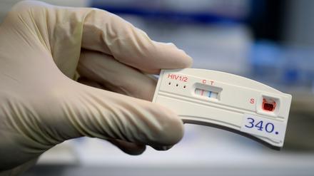 Der Teststreifen an einem HIV-Schnelltest verfärbt sich bei der Berliner Aids-Hilfe e.v. nach der Anwendung mit dem Blut eines Mannes.