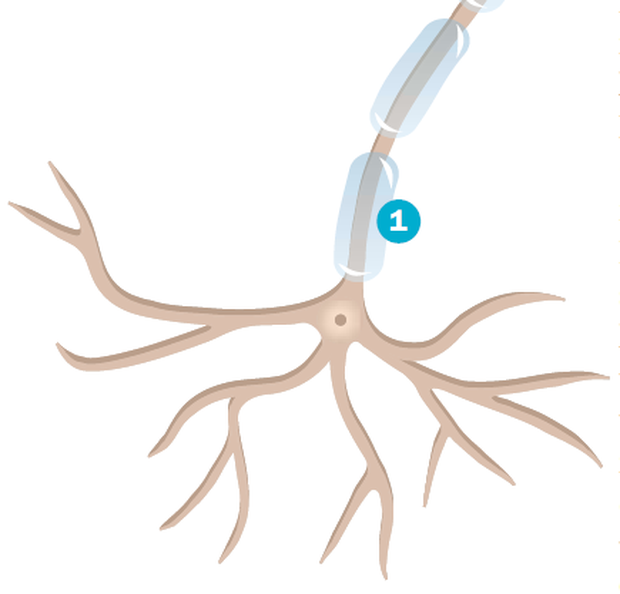 Multiple Sklerose betrifft das zentrale Nervensystem. An den Markscheiden (1), die die Schutzschicht der Nervenfasern in Gehirn und Rückenmark bilden, entstehen Entzündungen. Diese führen dazu, dass die Befehle des Gehirns nur noch eingeschränkt zu den Muskelzellen des Körpers weitergeleitet werden.