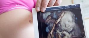 Der test mit Ultraschall (Sonografie) kommt während der Schwangerschaft dreimal zum EInsatz. 