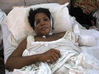 Marie-Julie Guerrier-Dumé kurz nach dem Beben im Januar 2010 im Hospital Espoir in Port-au-Prince. Ihr linker Arm war von Trümmern zerquetscht worden und musste amputiert werden. Foto: Ingrid Müller