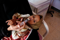 Dramatisch unterernährt sind im Jemen viele Tausend Kinder. Foto: Mohammed Mohammed/imago/Xinhua