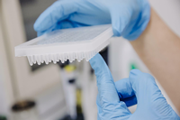 Eine Labortechnikerin arbeitet mit PCR-Tests im mikrobiologischen Labor eines öffentlichen Krankenhauses. Foto: dpa