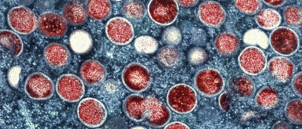 ARCHIV - 26.07.2022, USA, Fort Detrick: Eine eingefärbte Mikroskopaufnahme von mpox-Partikeln (rot) in einer infizierten Zelle (blau), die im Labor kultiviert wurde. (zu dpa «Zehn Affenpocken-Fälle im vergangenen Jahr in Thüringen») Foto: Uncredited/National Institute of Allergy and Infectious Diseases/dpa +++ dpa-Bildfunk +++