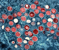 Eine kolorierte transmissionselektronenmikroskopische Aufnahme von Partikeln des Affenpockenvirus (Symbolbild). Foto: dpa/Planet Pix via ZUMA Press Wire/Niaid