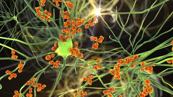 Antikörper greifen Nervenzellen an (Illustration)
