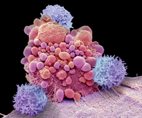 Immunzellen gegen Tumore scharf gemacht