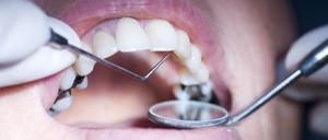 "patient having a dental examination up, close up with narrow depth of field focus on probe"