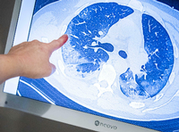 Ein behandelnder Arzt zeigt auf die CT-Aufnahme der Lunge eines Patienten, der sich mit dem Coronavirus infiziert hat. Foto: dpa/ Remko De Waal