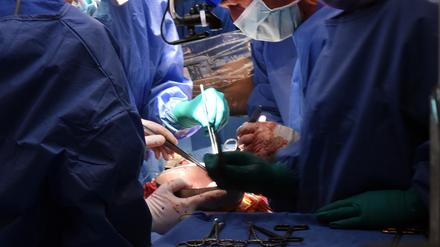 Chirurgen der Universität Maryland transplantierten einem 58-jährigen Herzpatienten ein Schweinenerz, um sein Leben zu retten.