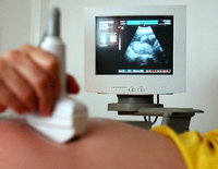 Schwangerschaft im Ultraschall. Die Information darüber, dass sie auch Abbrüche durchführen, verbietet Ärzten aktuell der Paragraf 219a. Foto:Patrick Pleul/dpa-tmn