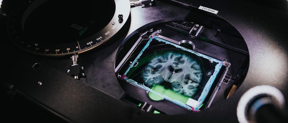 Menschlicher Hirnschnitt im Spezialmikroskop zur Darstellung von Nervenfasern.