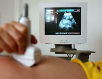 Schlechte Erfahrungen. Schwangere, die sich einen Kaiserschnitt wünschen, haben oft bereits eine komplizierte natürliche Geburt hinter sich. Foto: dpa
