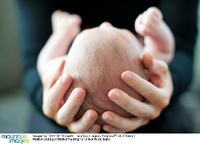 Schädel-Deformationen bei Neugeborenen
