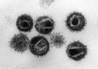 Im Bild eine elektronenmikroskopische Aufnahme mehrerer HI-Viren, Erreger der Immunschwäche-Krankheit Aids. Foto: Hans Gelderblom/Robert Koch Institut/dpa