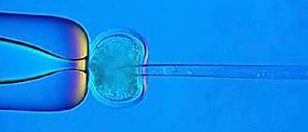 Die Entscheidung des Europäischen Gerichtshofs zur Stammzellenforschung hat weitreichende Konsequenzen.