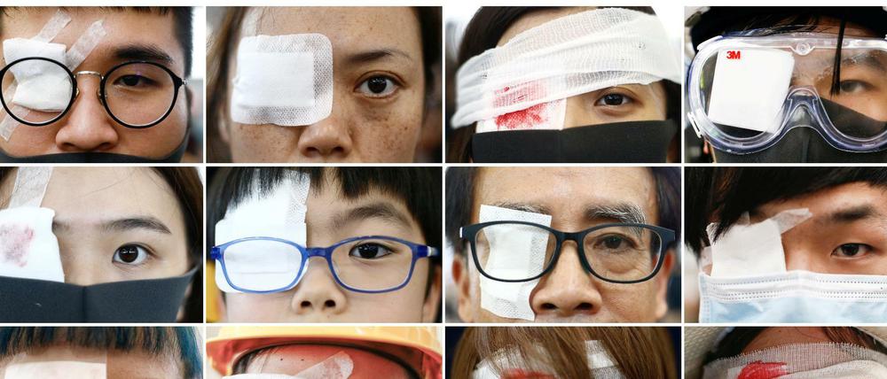 Hongkonger demonstrieren mit einem abgeklebten Auge gegen Polizeigewalt. Am Vortag hatte eine Demonstrantin die Sehkraft auf einem Auge verloren. 