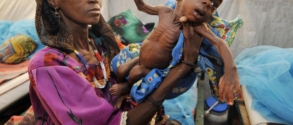 Unterernährung wie hier in Niger ist eine der großen Herausforderung der Entwicklungspolitik.