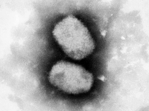 Elektronenmikroskopische Aufnahmen zeigt das Affenpockenvirus.
