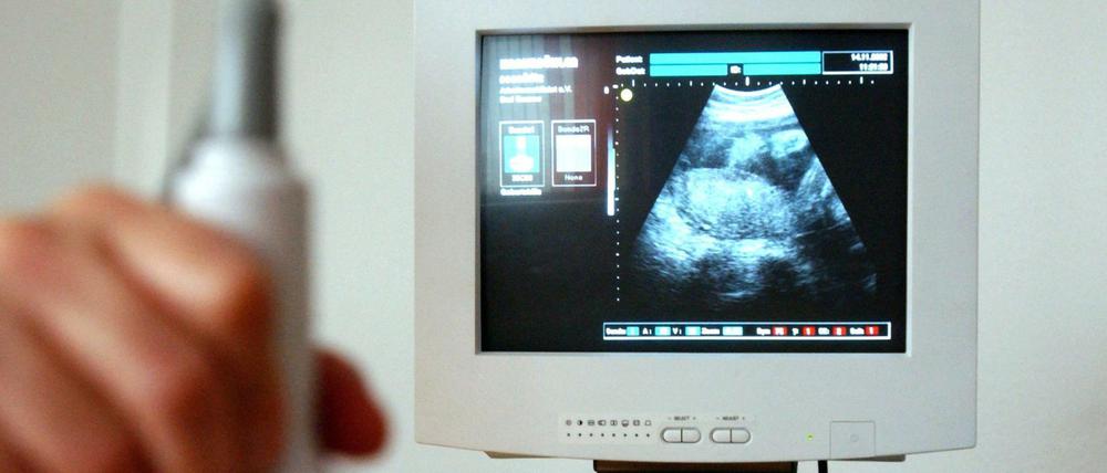 Schwangerschaft im Ultraschall. Die Information darüber, dass sie auch Abbrüche durchführen, verbietet Ärzten aktuell der Paragraf 219a.