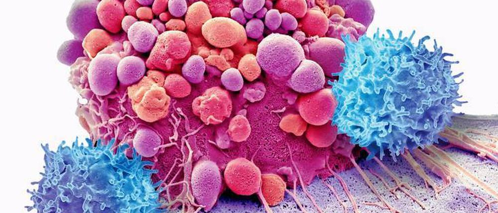 Abwehrkampf: Im Elektronenmikroskop wird sichtbar, wie Immunzellen (blau) eine Krebszelle (rot) attackieren.