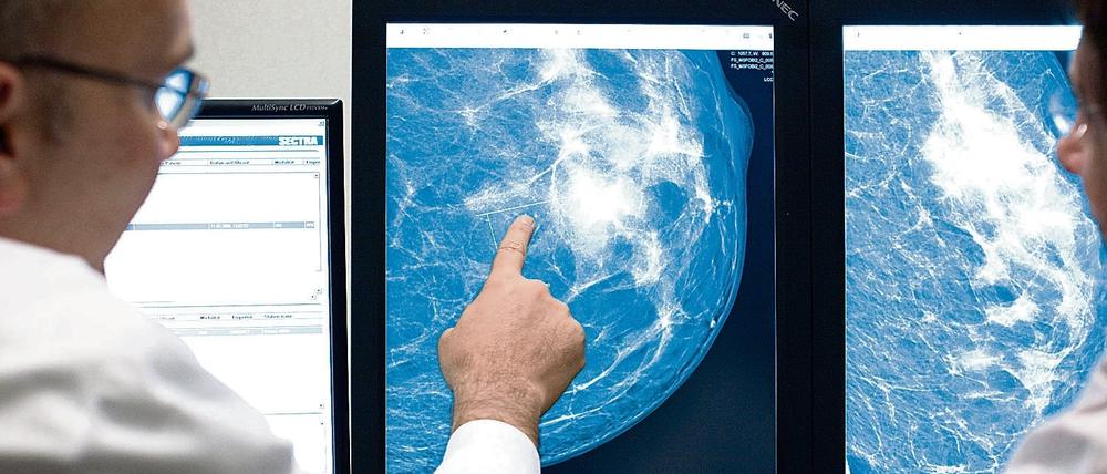 Auf der Suche nach besseren Behandlungsmöglichkeiten. Ein Radiologe deutet im Referenzzentrum Mammographie am Uniklinikum Münster auf eine Auffälligkeit in einer weiblichen Brust.