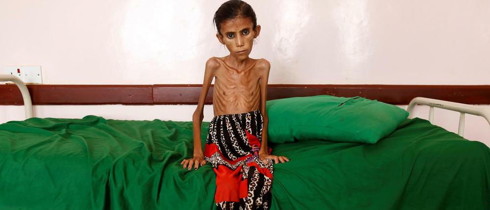 Abgemagert bis auf die Knochen. Fatima ist zwölf Jahre alt – und wiegt gerade einmal zehn Kilogramm. Millionen Kinder im Jemen hungern.