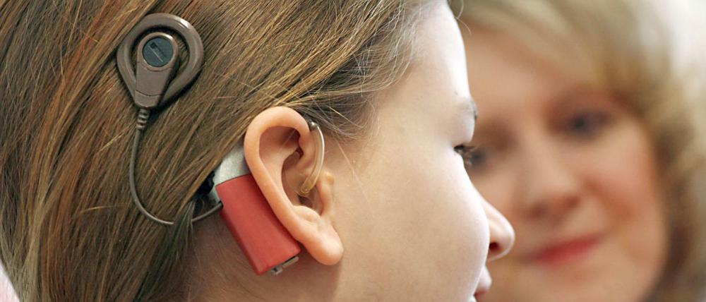 Ein Mädchen mit Cochlea-Implantat. Solche Geräte wandeln Schall in elektrische Impulse um, durch die der Hörnerv in der Hörschnecke stimuliert wird.
