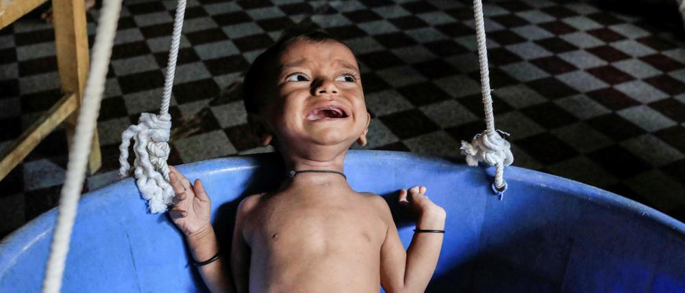 Ein unterernährter Rohingya-Junge in einem Flüchtlingslager in Bangladesch.