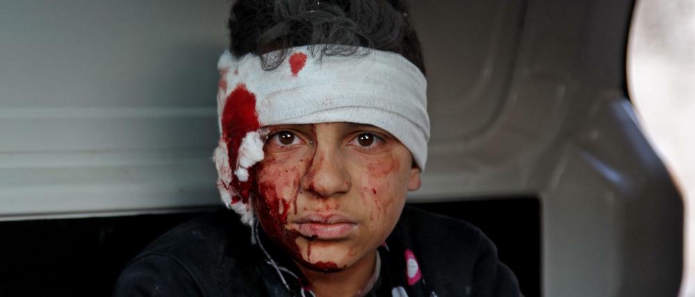 Kriegsopfer: Nach einem Luftangriff von regierungstreuen Kräften wird ein verwundeter Junge in der Stadt Maarrat Misrin in der syrischen Provinz Idlib abtransportiert.